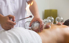 Cupping Pain Relief Therapy North London Southgate N14 Therapist giving Vacuum Hot Fire Cupping on patient's back