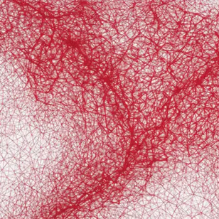 Œuvre unique ou édition limitée : que privilégier ?