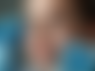 Pelle Perfetta: Microneedling e Trattamenti Anti-Aging