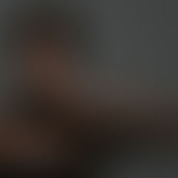 Reflux gastro-œsophagien (RGO) : quand l’estomac parle au corps