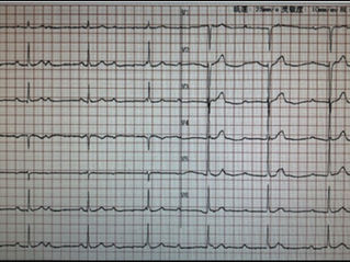 心跳慢了怎麼辦？