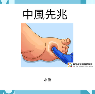 中風先兆: 水腫