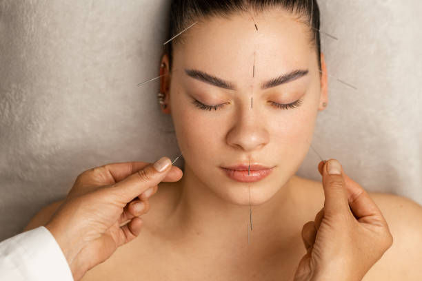 Mastering Accurate Acupuncture Coding & Billing