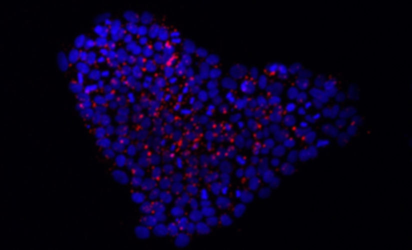 ipsc 1-1 ssea4-merged 1_edited.jpg