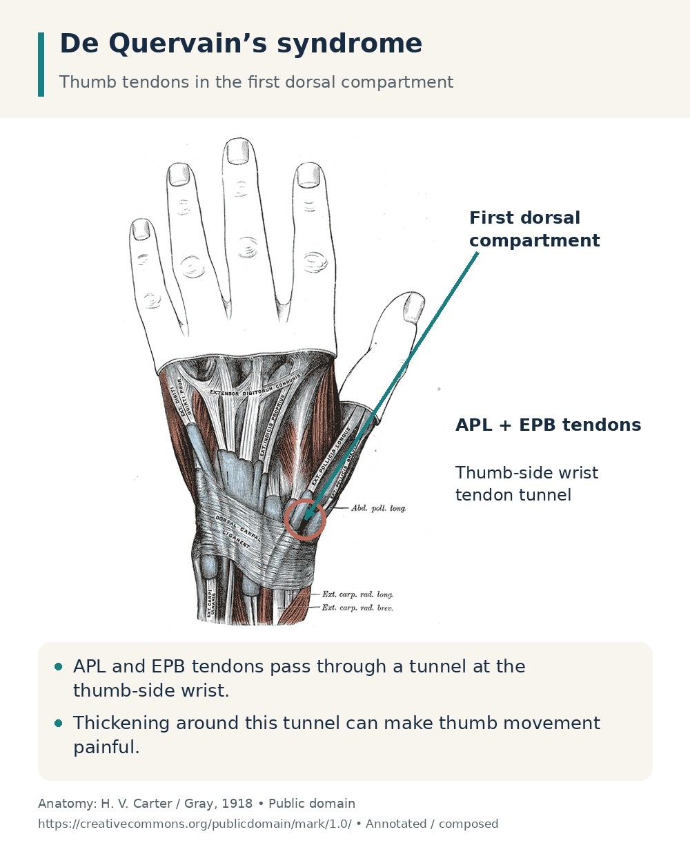 APL and EPB thumb tendons highlighted at the first dorsal compartment on the thumb side of the wrist.