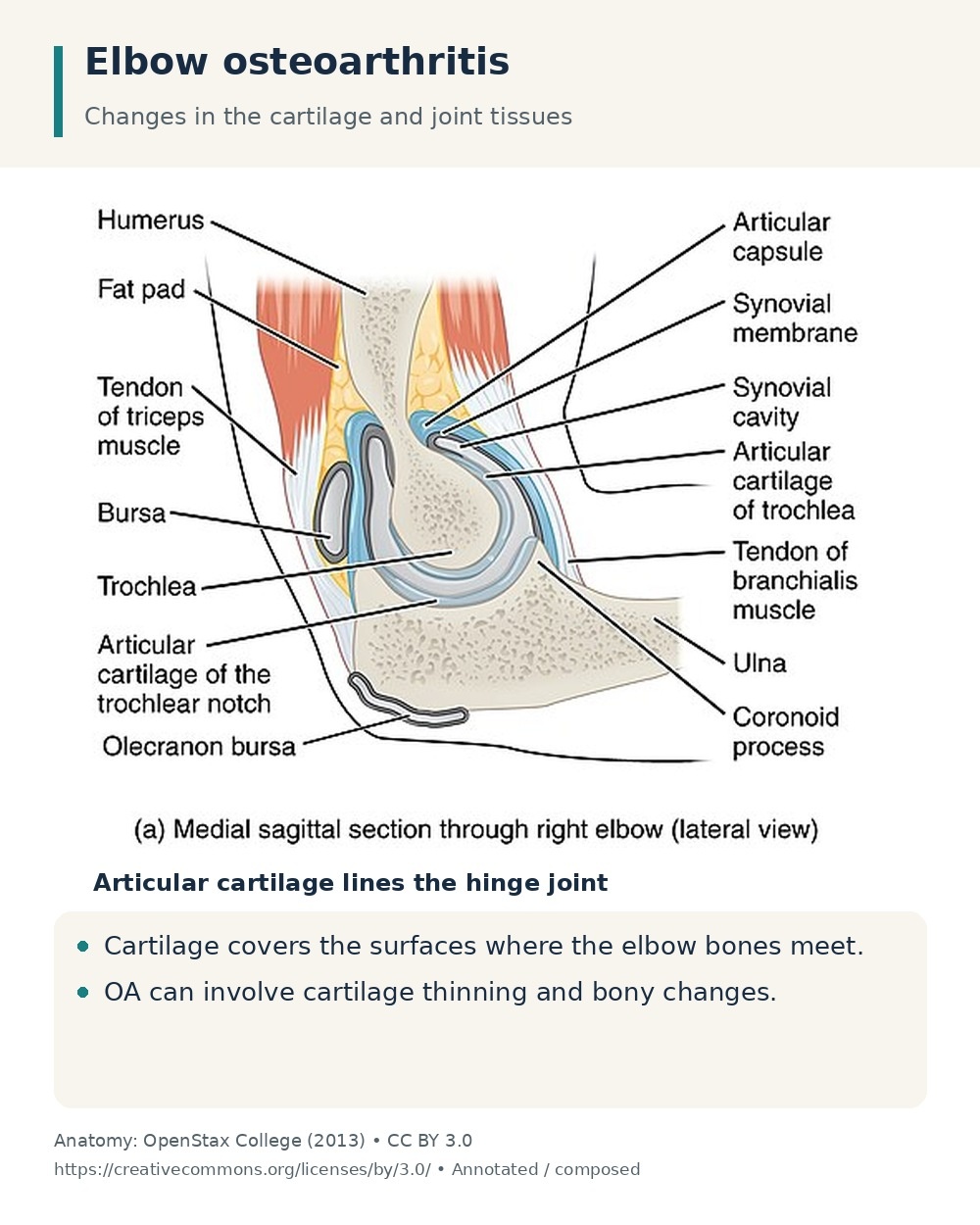 Sagittal elbow anatomy identifying articular cartilage on the humerus and ulna, the tissues affected by osteoarthritis.