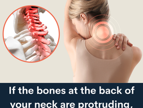 Is the “bone” at the back of your neck sticking out? C7 prominence vs “buffalo hump”, causes & proven relief
