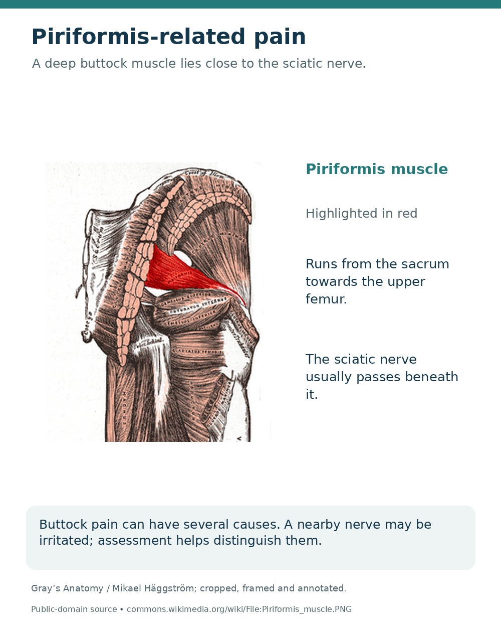Deep gluteal anatomy with the piriformis muscle highlighted red, running from the sacrum towards the upper femur.
