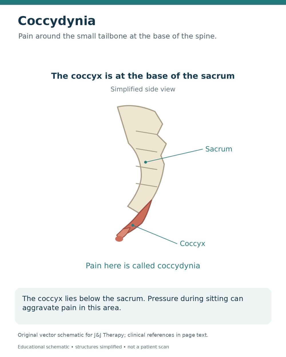 Simplified side view of the sacrum and coccyx, with the small tailbone highlighted below the sacrum.
