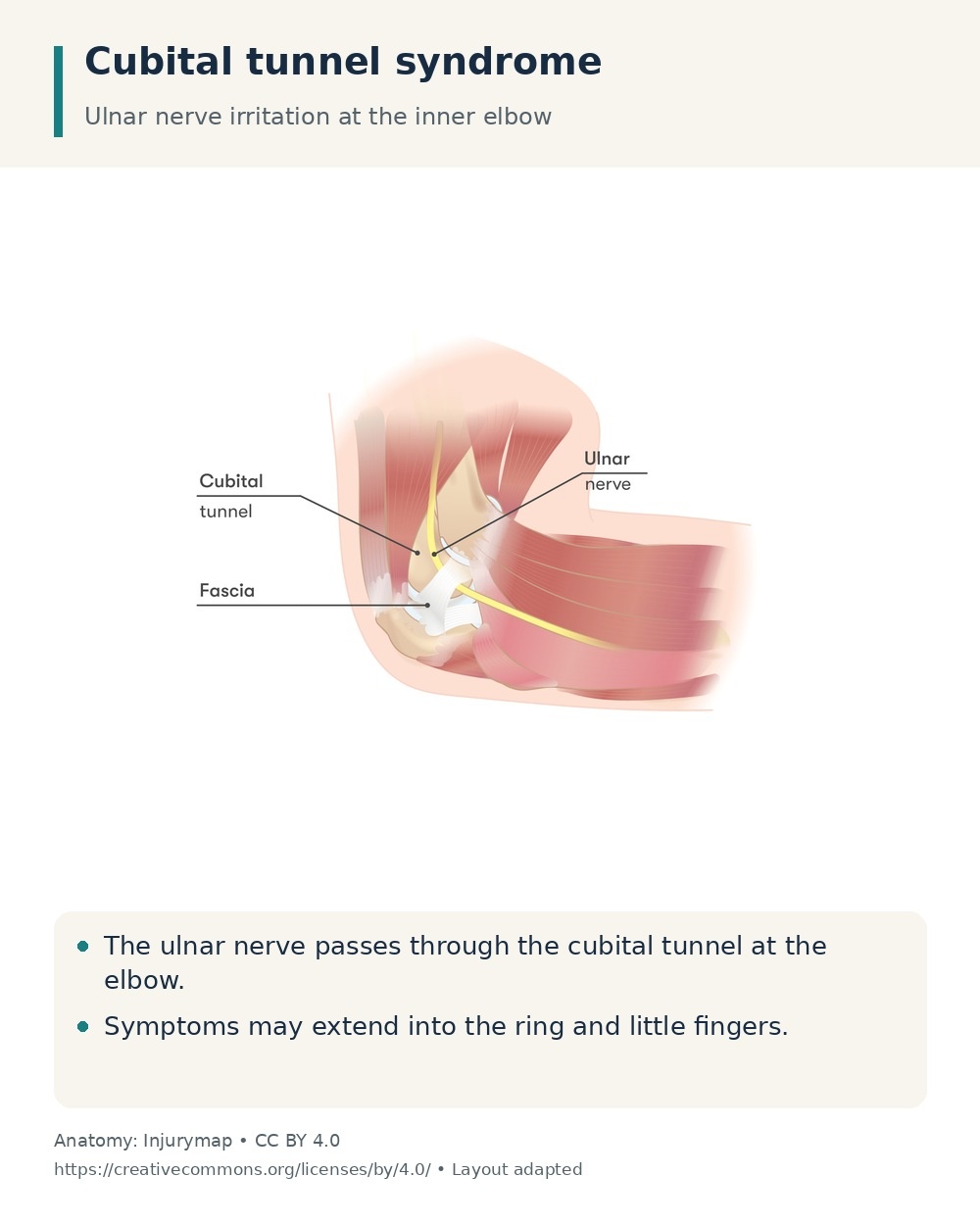 Ulnar nerve passing through the cubital tunnel at the inner elbow, with surrounding fascia identified.