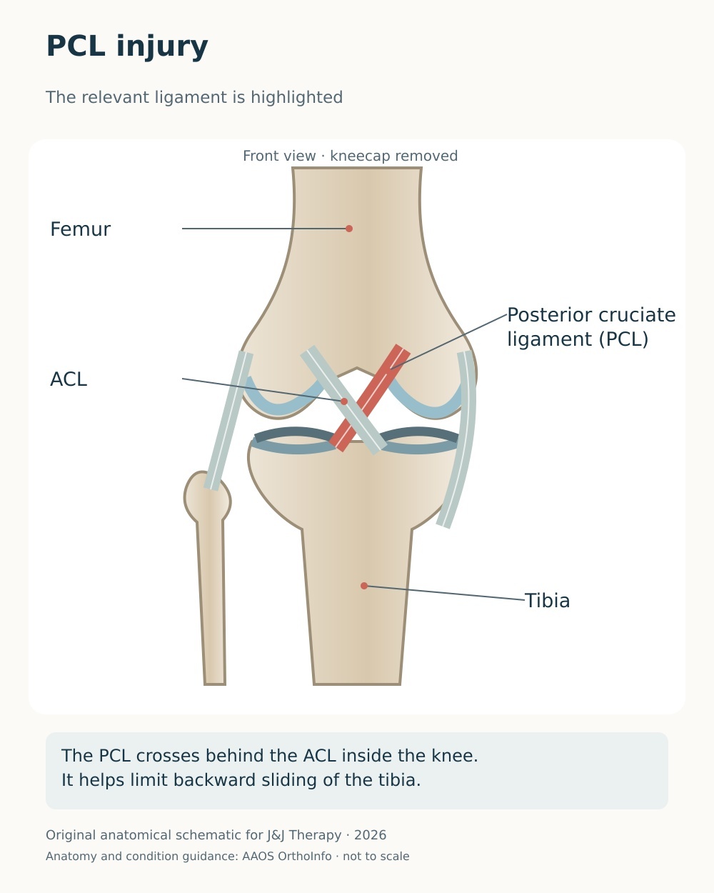 Anterior knee diagram highlighting the posterior cruciate ligament behind the ACL within the knee joint.