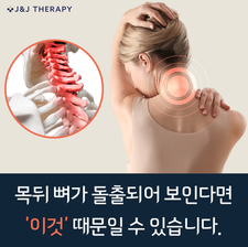 목 뒤 통증을 짚는 여성과 C7 경추 그림이 보이는 커버 이미지.