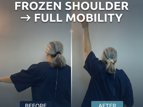 Can't Lift Your Arm? How We Treat Frozen Shoulder