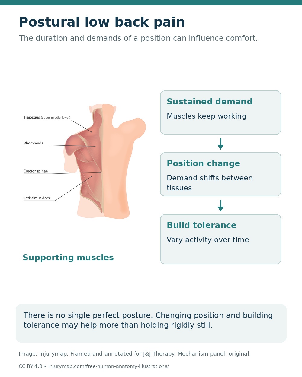 Back muscle anatomy beside a diagram of sustained demand, position changes and gradually building activity tolerance.