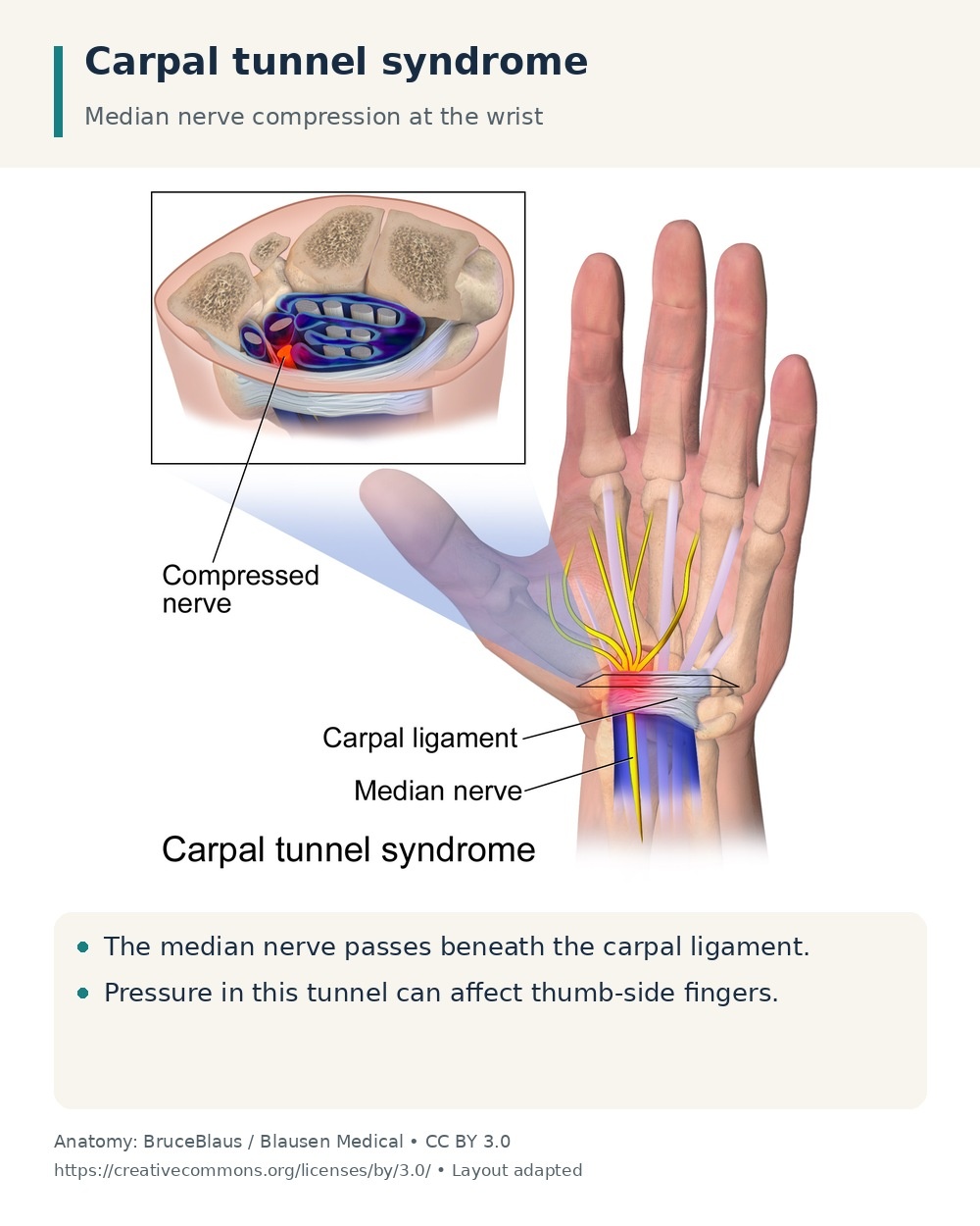 Median nerve and carpal ligament at the wrist, with a cross-section showing the carpal tunnel.