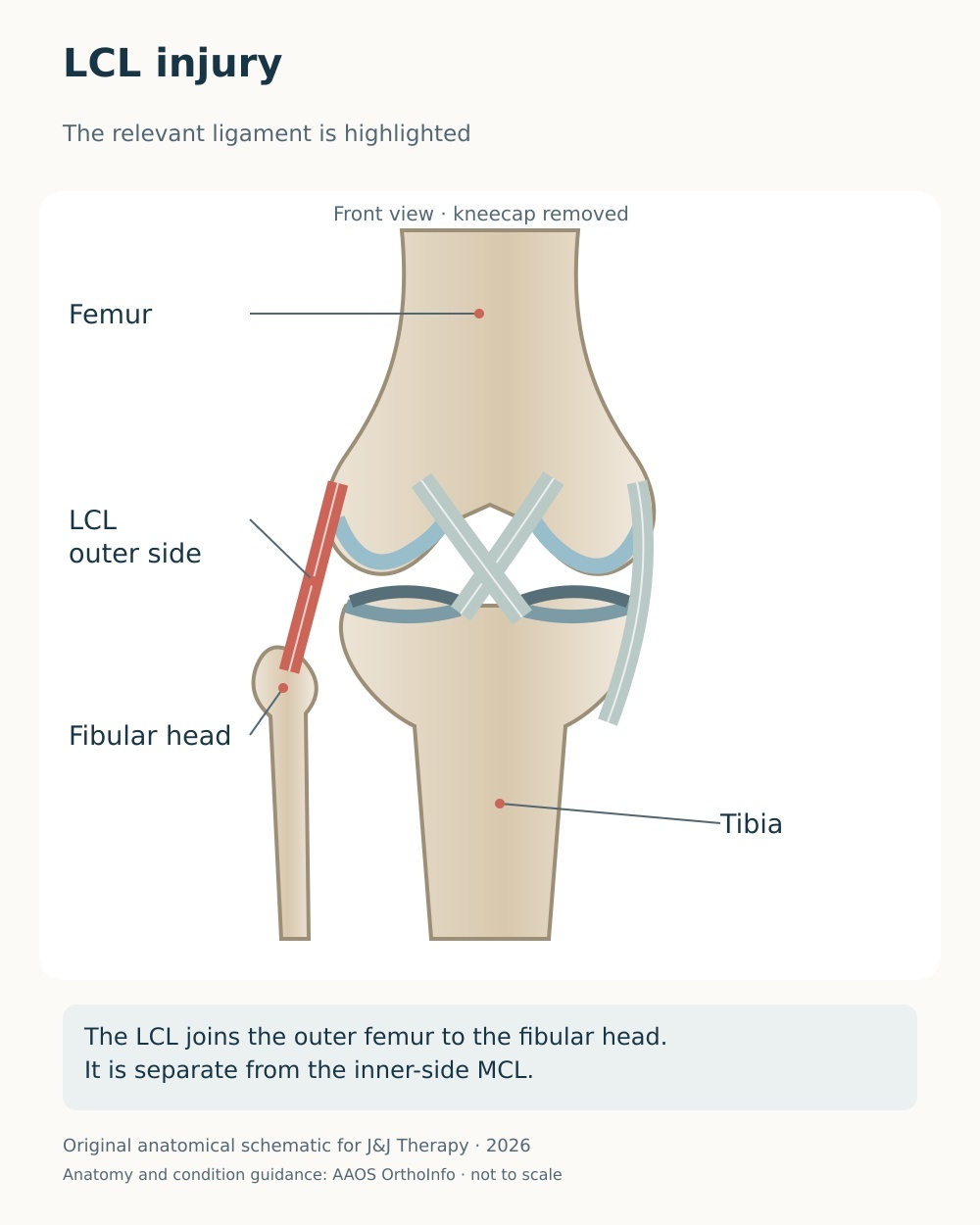 Anterior knee diagram highlighting the lateral collateral ligament from the outer femur to the fibular head.