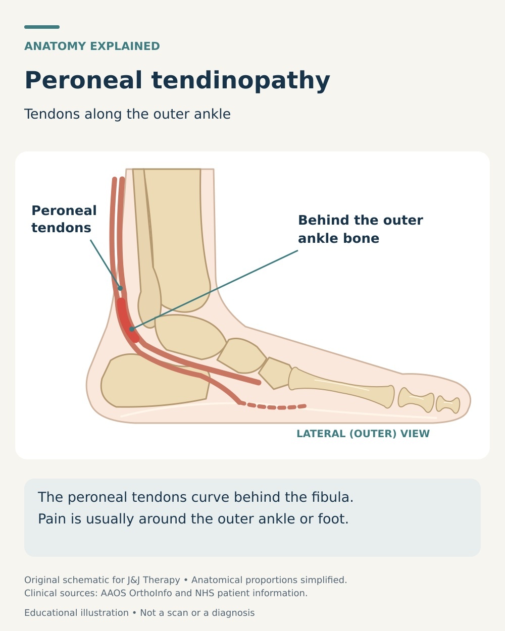 Lateral ankle anatomy showing the peroneal tendon paths behind the outer ankle bone and into the foot.