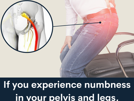 Piriformis Syndrome: the hidden cause of buttock pain, tingling and ‘dead‑leg’ sensations