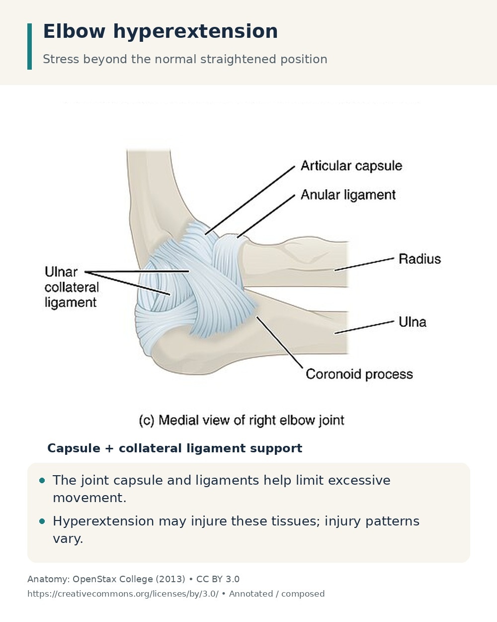 Medial elbow anatomy identifying the joint capsule and collateral ligament support that can be injured by excessive extension.
