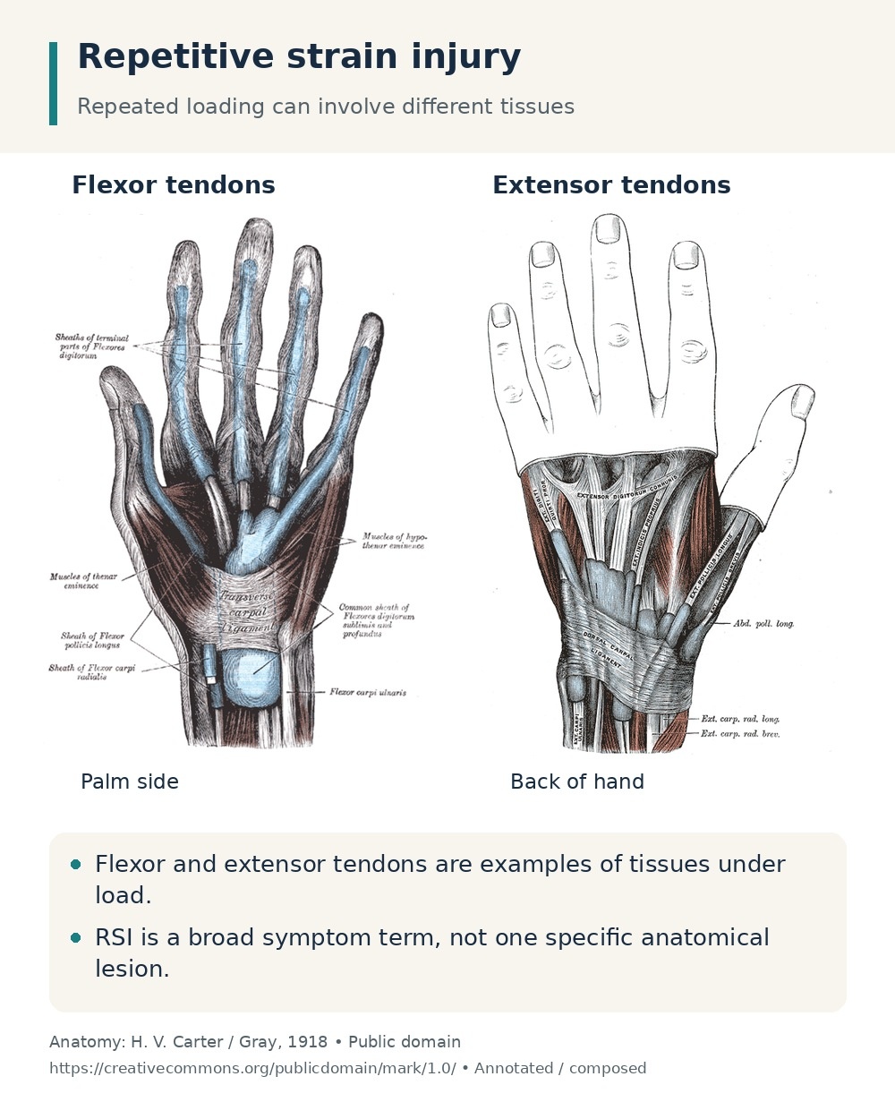 Palm-side flexor and back-of-hand extensor tendon anatomy, illustrating tissues that may be affected by repetitive loading.