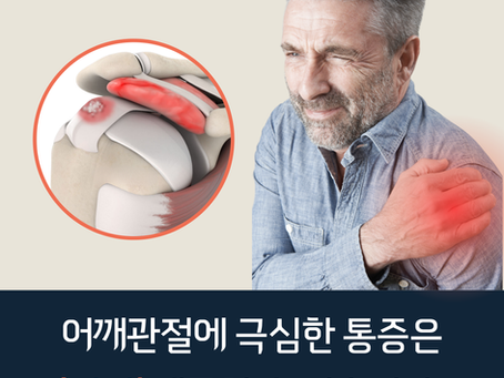 “팔만 들어도 찌릿!” — 어깨 충돌증후군과 석회성 건염의 악순환