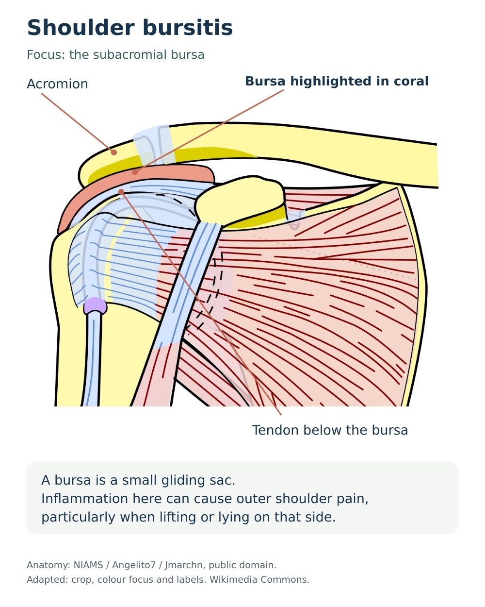 Anatomical diagram highlighting the subacromial bursa above the rotator cuff tendon.