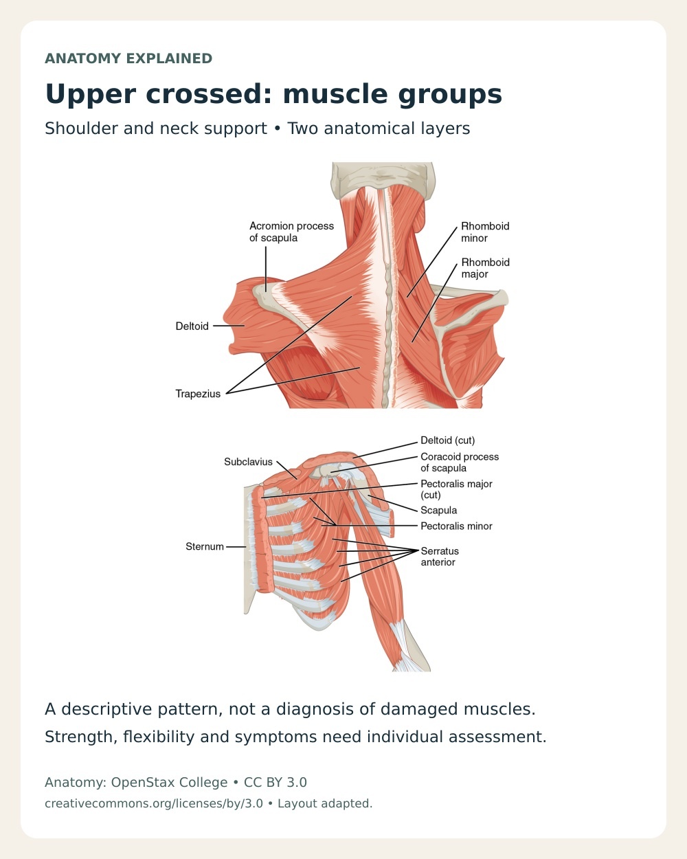 Upper crossed muscle-group anatomy showing posterior trapezius and rhomboids alongside anterior pectoralis minor and serratus anterior.
