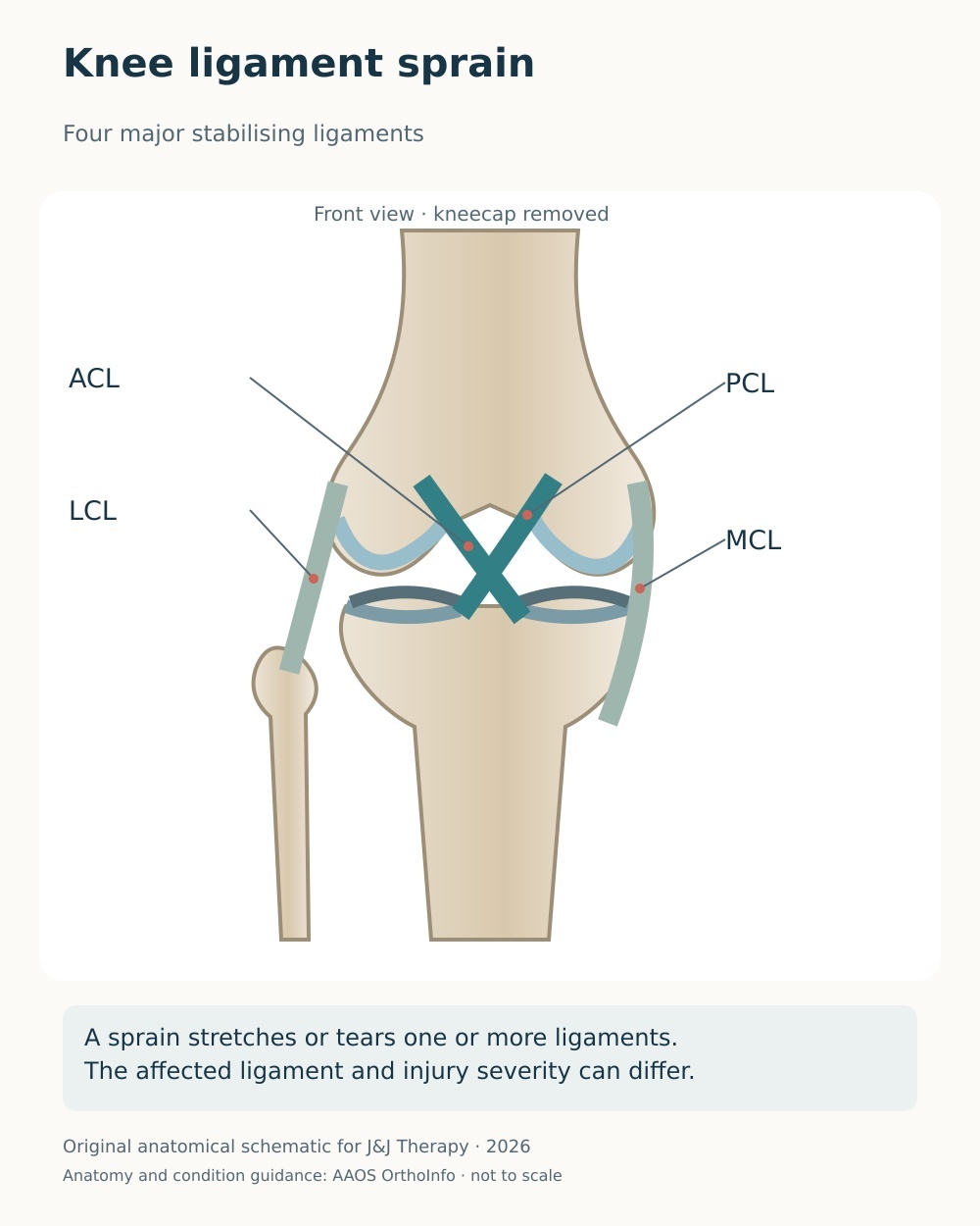 Anterior knee diagram labelling the ACL, PCL, MCL and LCL as the four major knee stabilising ligaments.