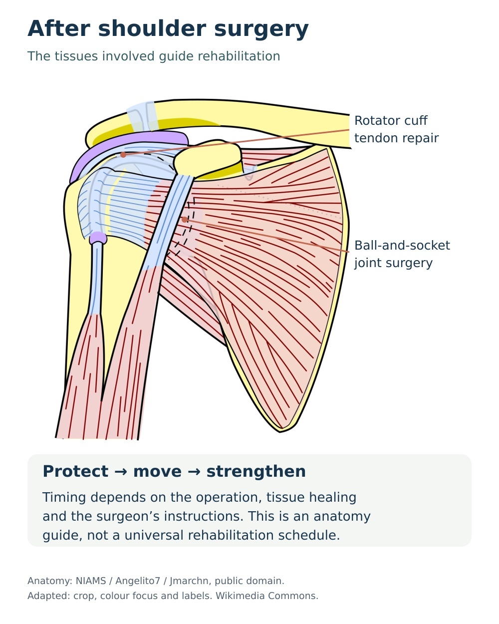 Anatomy guide showing rotator cuff and ball-and-socket structures relevant to different shoulder operations.