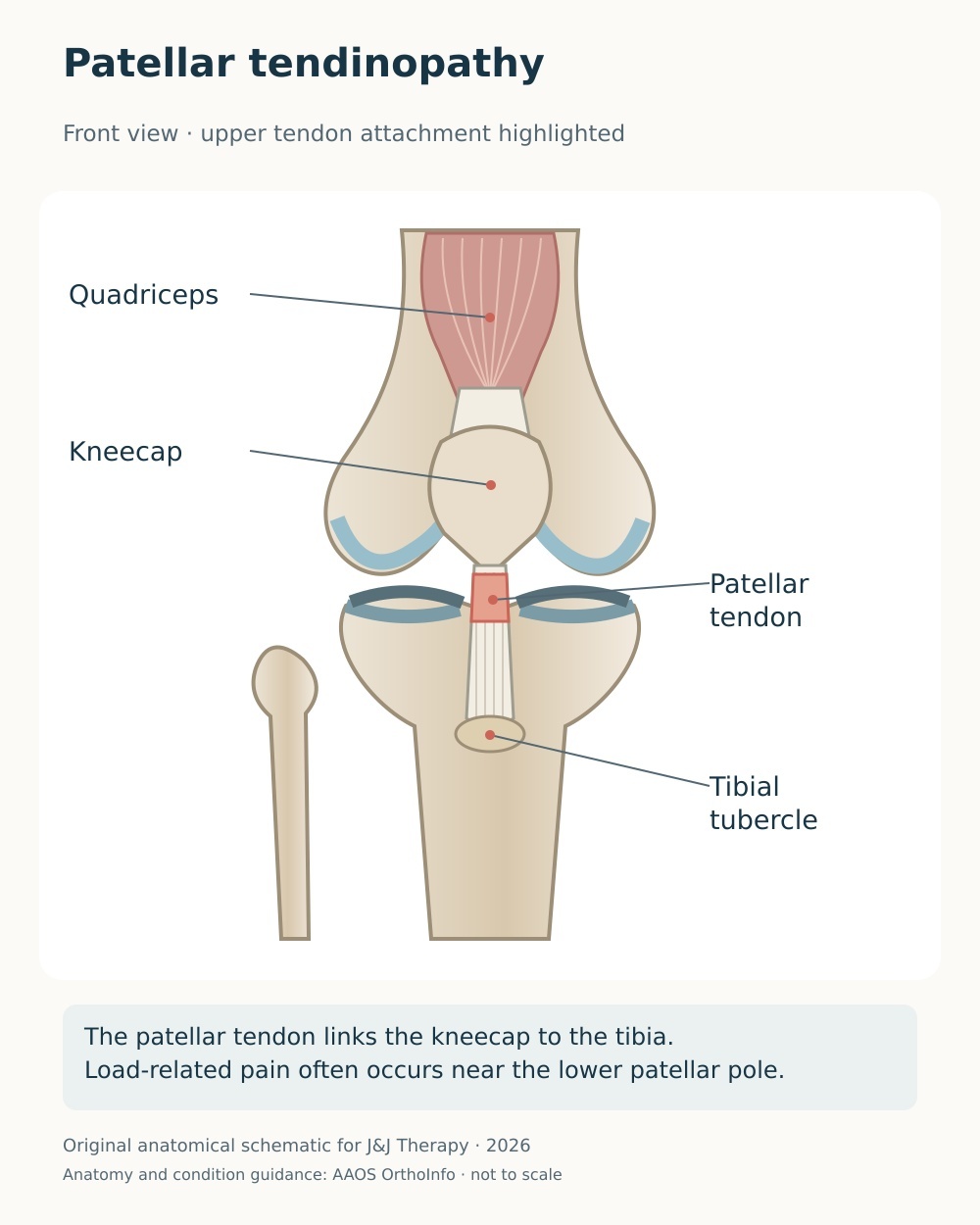 Anterior extensor-mechanism diagram highlighting the patellar tendon near its attachment below the kneecap.