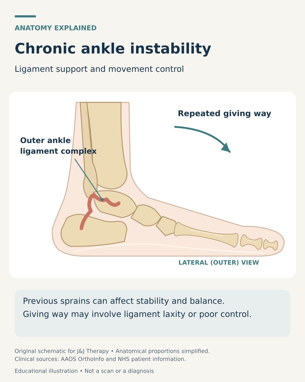 Outer ankle ligament diagram explaining repeated giving way and the roles of ligament support and movement control.