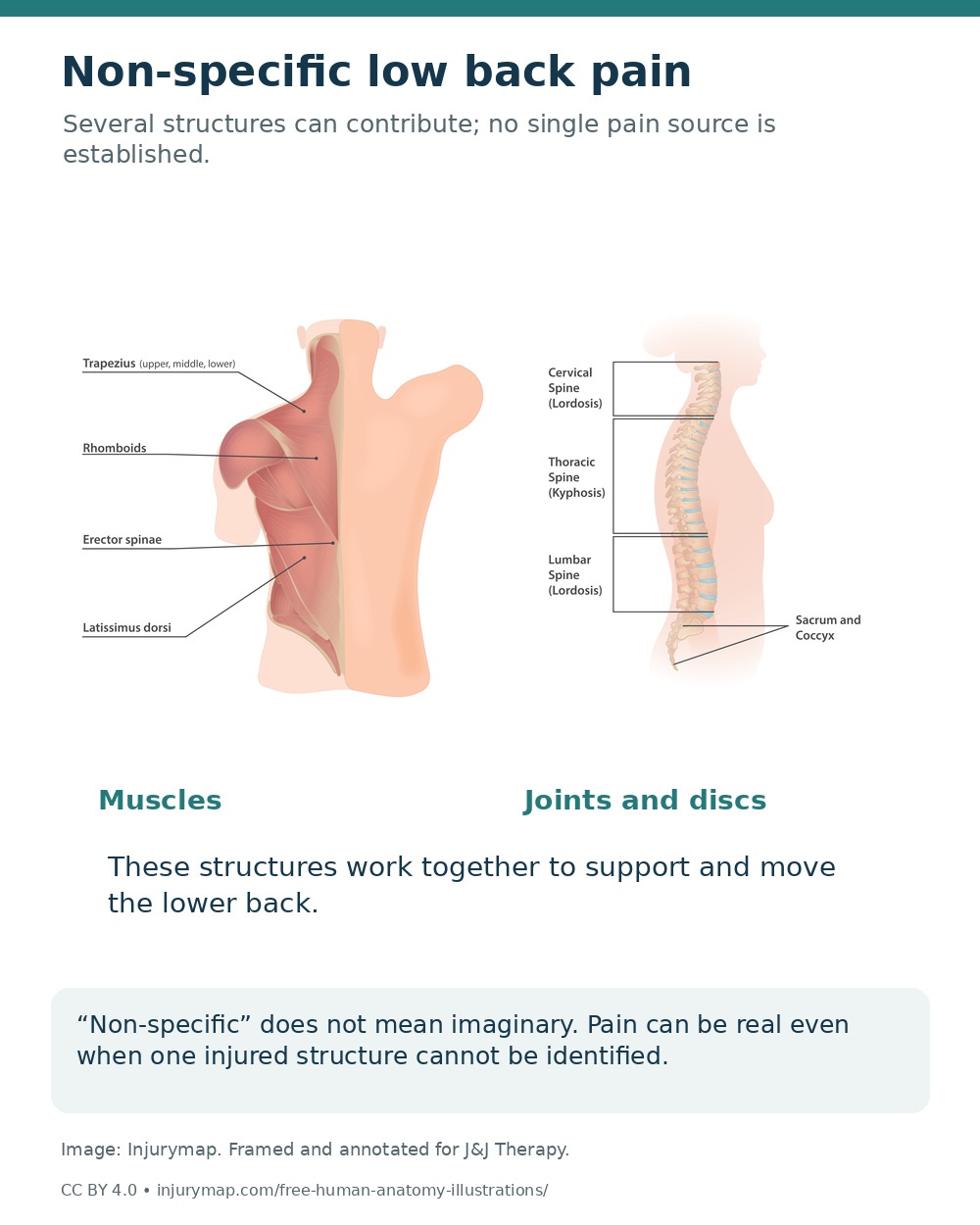Back muscle and spinal anatomy explaining that several structures can contribute to non-specific lower-back pain.