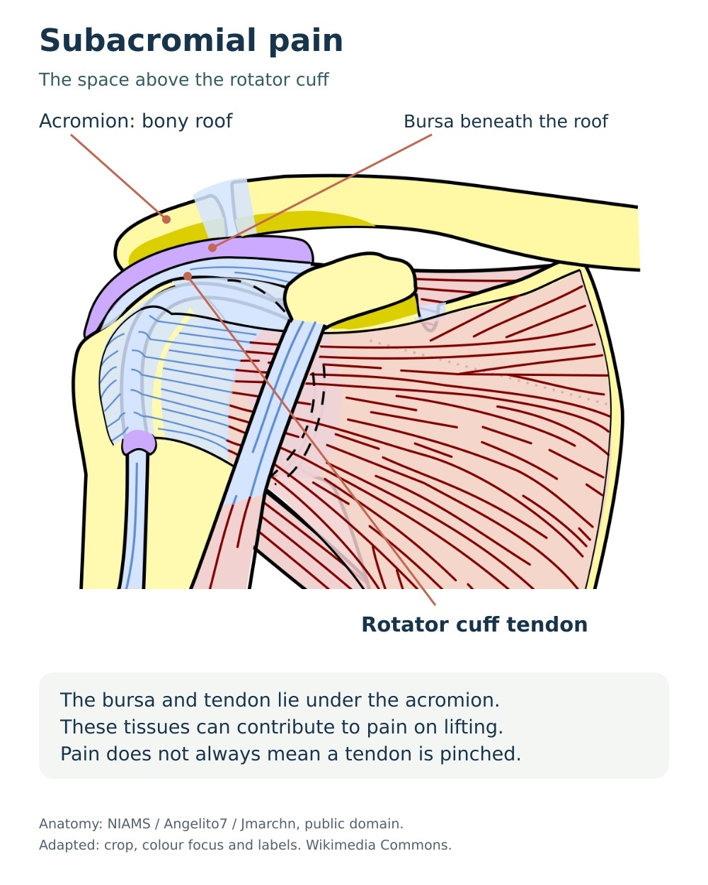 Anatomical diagram showing the acromion, subacromial bursa and underlying rotator cuff tendon.