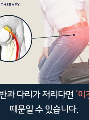 엉덩이와 다리가 저릿저릿? ‘이상근 증후군’을 의심하세요!