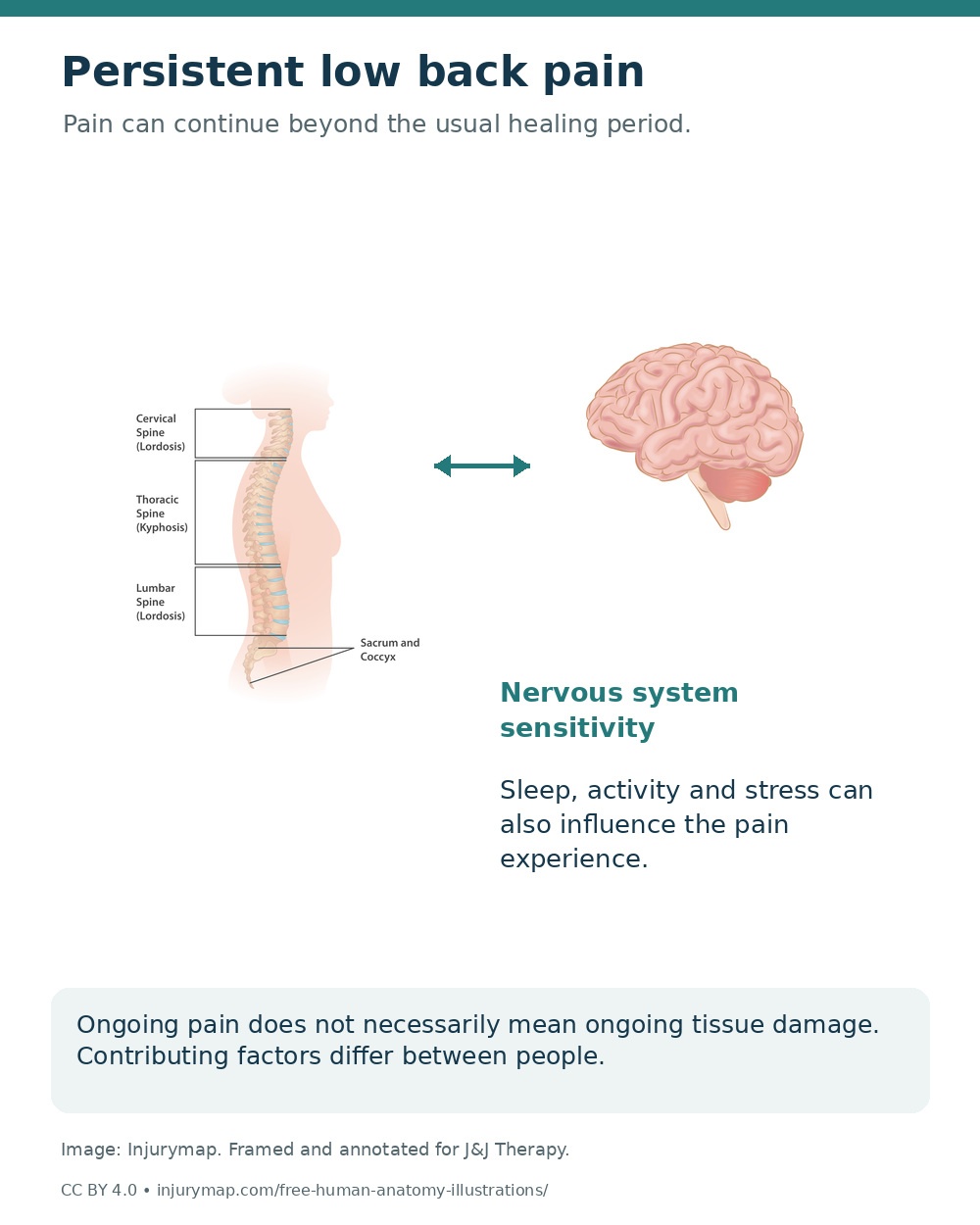 Spinal and brain anatomy illustrating nervous-system sensitivity and factors that can influence persistent back pain.