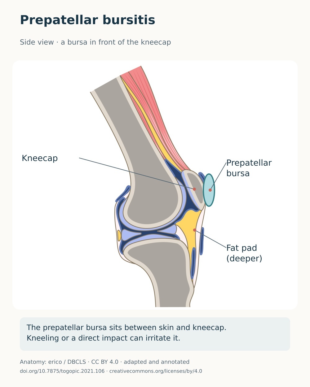 Sagittal knee anatomy showing the prepatellar bursa in front of the kneecap and the deeper fat pad.