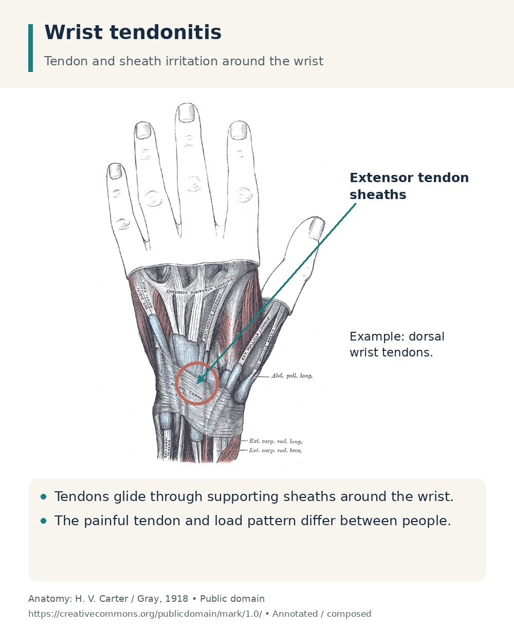 Dorsal wrist tendons and their supporting sheaths, with the extensor sheath region highlighted.