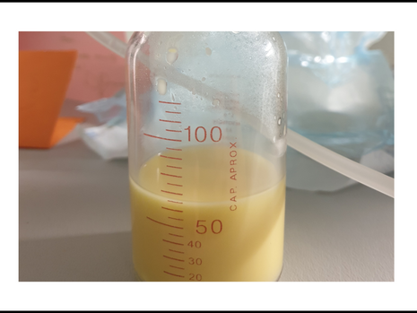 Colostrum: The Nutrient-Rich First Milk for Your Newborn Baby's Immune System
