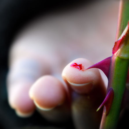 Rose-thorn disease