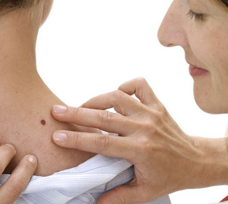 "C.A.U.T.I.O.N U.S." 9 warning signs and symptoms of cancer that we usually ignore