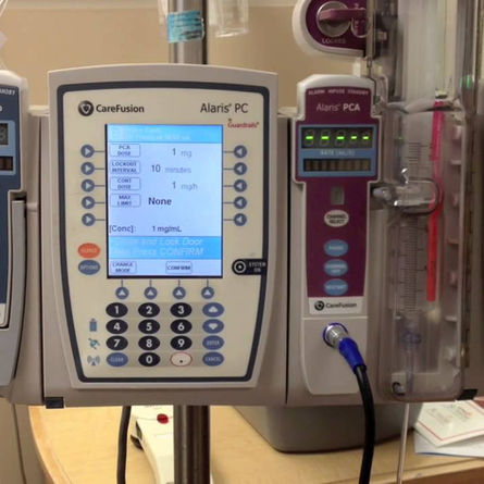 Patient Controlled Analgesia (PCA) What you need to know?