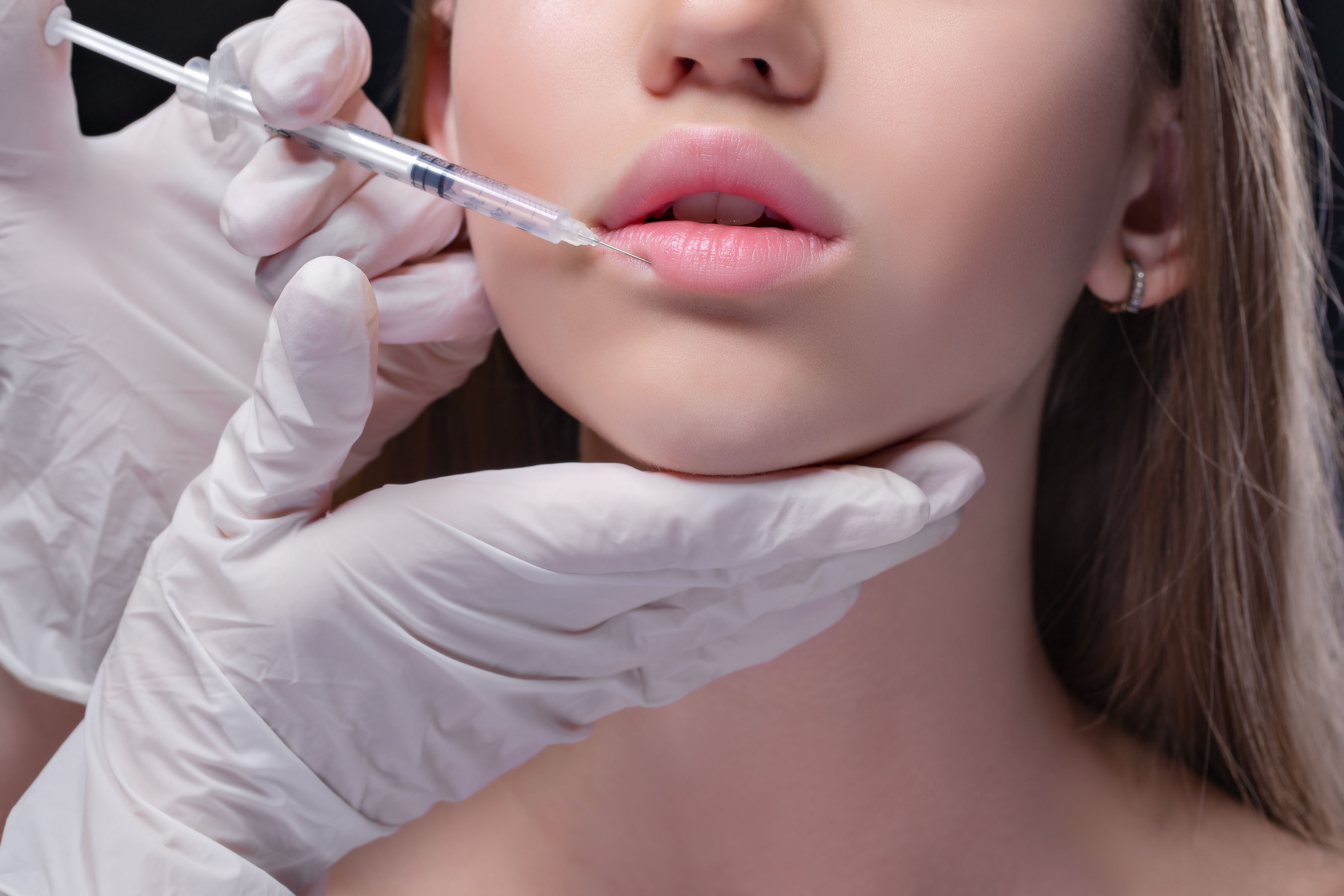 Female receiving lip filler treatment