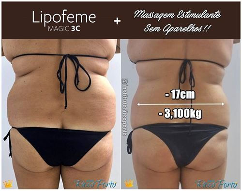 A MÁGICA COM LIPOFEME MAGIC 3C