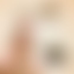 Peeling Químico ou Enzimático ?
