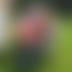 Ten-Year-Old Burn Victim Meets Dog With Four Prosthetic Legs