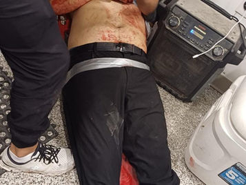 Exagente de la Policía Estatal es baleado mientras atendía un puesto de sushi en Tijuana