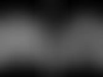 Primer tratamiento exitoso contra el Huntington: logran frenar la enfermedad en 75%