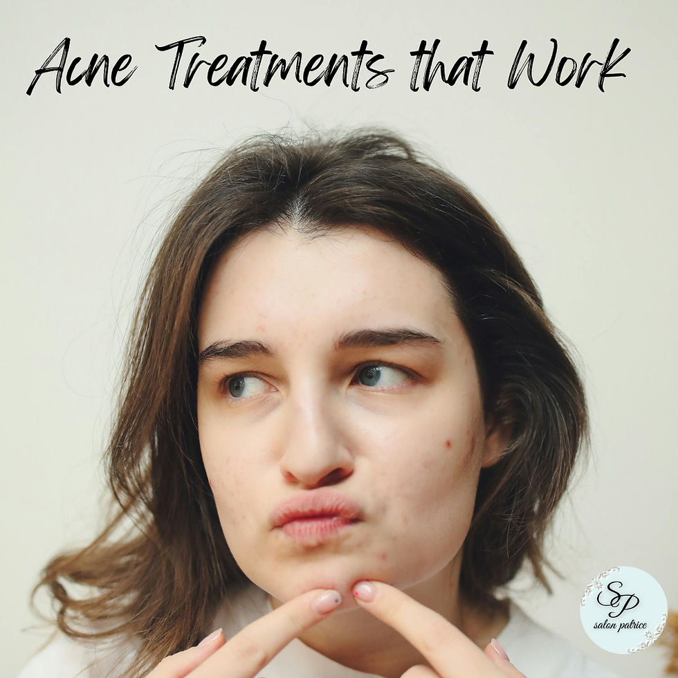 A teenage girl ready to pop a pimple on her chin