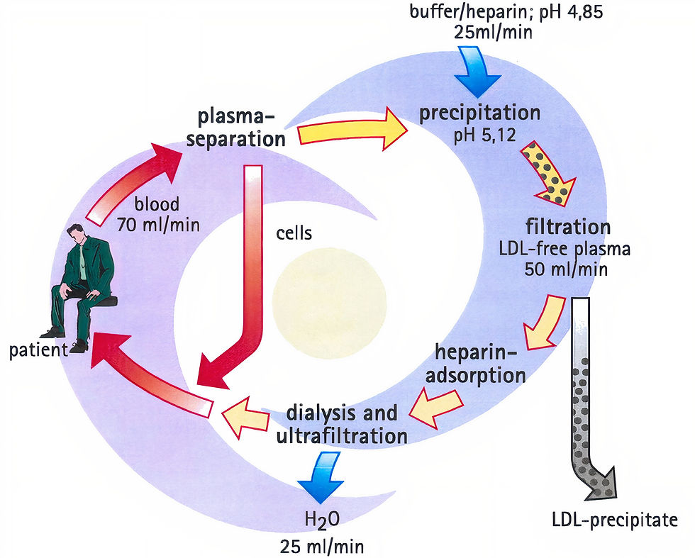Flow chart summarising the process of lipid apheresis in a patient