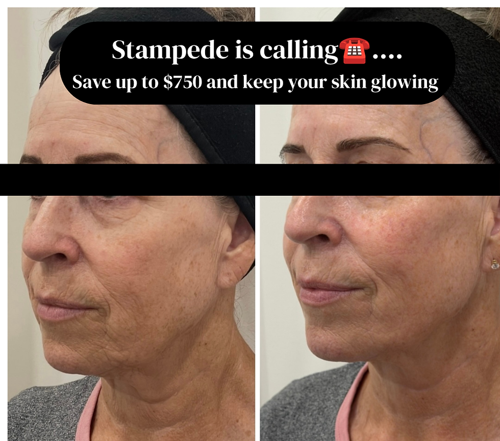 Stampede is coming.... Your skin is calling๐
